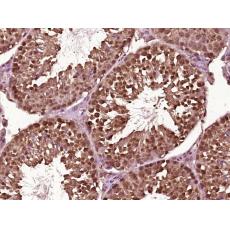 Anti-NUDCD1 antibody