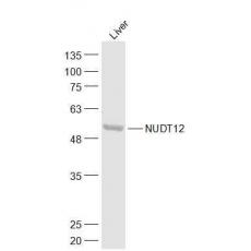 Anti-NUDT12 antibody