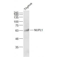 Anti-NUPL1 antibody
