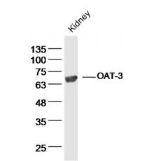 Anti-OAT-3 antibody