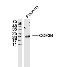 Anti-ODF3B antibody