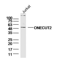Anti-ONECUT2 antibody