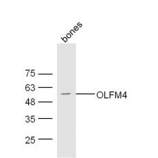 Anti-OLFM4 antibody