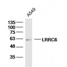 Anti-Optineurin antibody