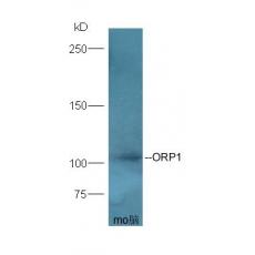 Anti-ORP1 antibody