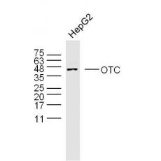 Anti-OTC antibody