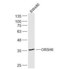Anti-OR5H6 antibody