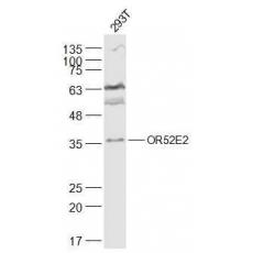Anti-OR52E2 antibody