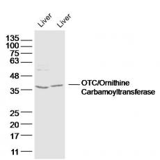 Anti-OTC/Ornithine Carbamoyltransferase antibody