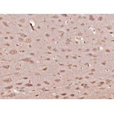 Anti-OXA1L antibody