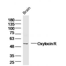 Anti-Oxytocin R antibody