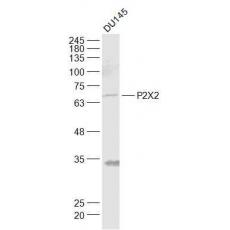 Anti-P2X2 antibody