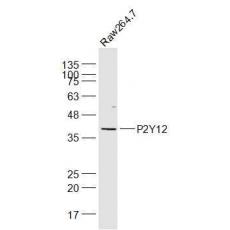 Anti-P2Y12 antibody