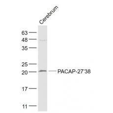 Anti-PACAP-27/38 antibody