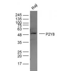 Anti-P2Y8 antibody