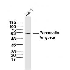 Anti-Pancreatic Amylase antibody