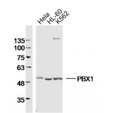 Anti-PBX1 antibody