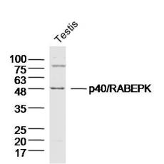 Anti-p40/RABEPK antibody