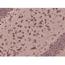 Anti-PAP2B antibody