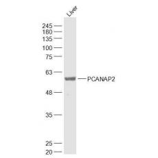 Anti-PCANAP2 antibody