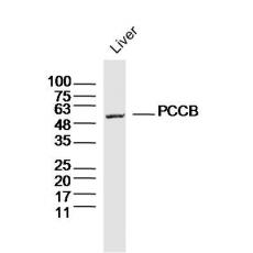 Anti-PCCB antibody