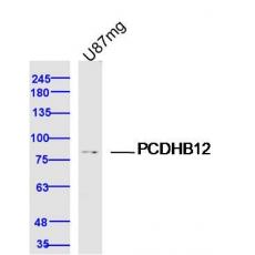 Anti-PCDHB12 antibody