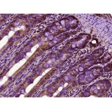 Anti-PATL2 antibody