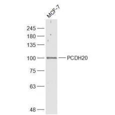 Anti-PCDH20 antibody