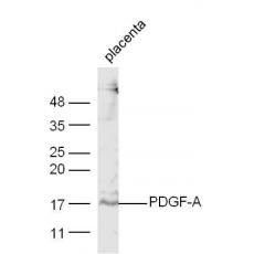 Anti-PDGF-A antibody
