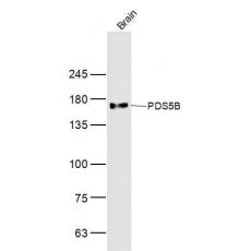 Anti-PDS5B antibody