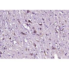 Anti-PDZD9 antibody