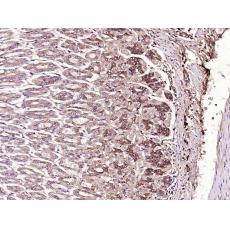Anti-PEDF antibody