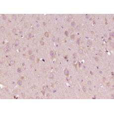 Anti-PDZD8 antibody