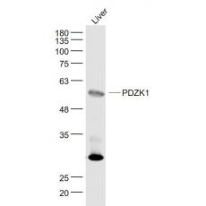 Anti-PDZK1 antibody