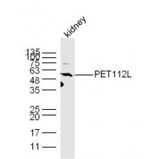 Anti-PET112L antibody
