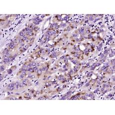 Anti-Phospholipase C beta 2 antibody