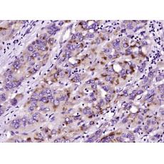 Anti-Phospholipase C beta 2 antibody