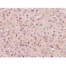 Anti-PKC iota antibody