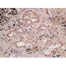 Anti-PCDHB10 antibody