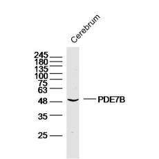 Anti-PDE7B antibody