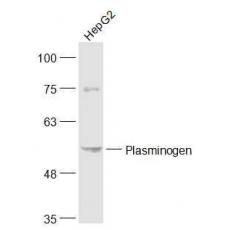 Anti-Plasminogen antibody