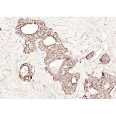 Anti-PLASTIN3 antibody
