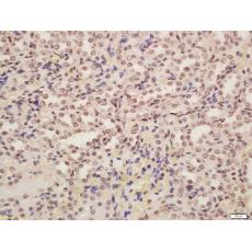 Anti-POD1 antibody