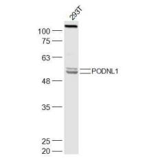 Anti-PODNL1 antibody