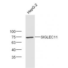 Anti-SIGLEC11 antibody