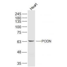 Anti-PODN antibody