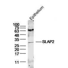 Anti-SLAP2 antibody