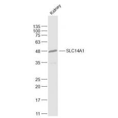 Anti-SLC14A1 antibody