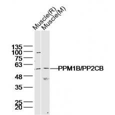 Anti-PPM1B/PP2CB antibody