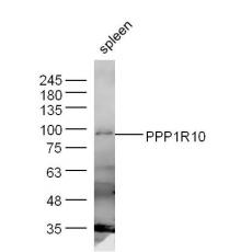 Anti-PPP1R10 antibody